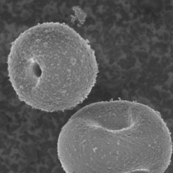 Introduction to zeolites